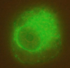 fluorescence shows siRNA distributed throughout cellular fluid