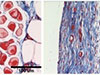 image of collagen differences in tissue with and without the hydrogel