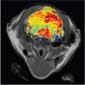 Fluorescent nanoparticle enhanced image of brain tumor in mouse