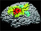 levels of brain activity identified by color