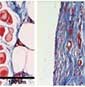 image of collagen differences in tissue with and without the hydrogel