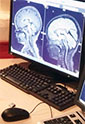a magnetic resonance spectroscopic image of a child's brain chemistry on a computer screen