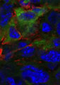 stained cross-section of a mouse tumor