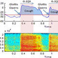 CoughSense uses the phone’s microphone to monitor cough frequency for a single person or, when networked, to track trends across an entire population