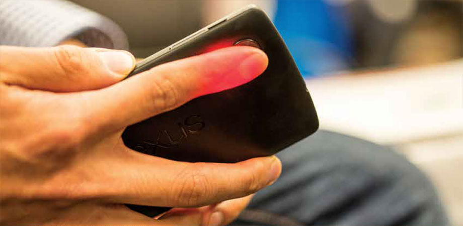HemaApp measures hemoglobin in the blood
using a smartphone’s camera.