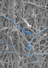 A micron-level image of web-like, gel structure that forms after fluid passes through the flow device