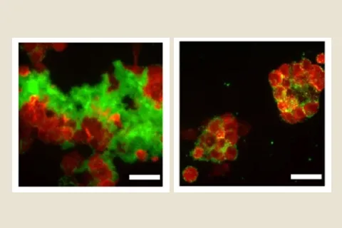 Red and green fluorescence microscopy images of biofilm solubility and bacteria