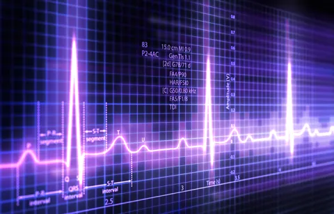 Purple heartbeat line