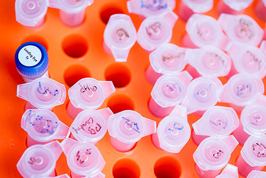 Many vials sitting on an orange tray