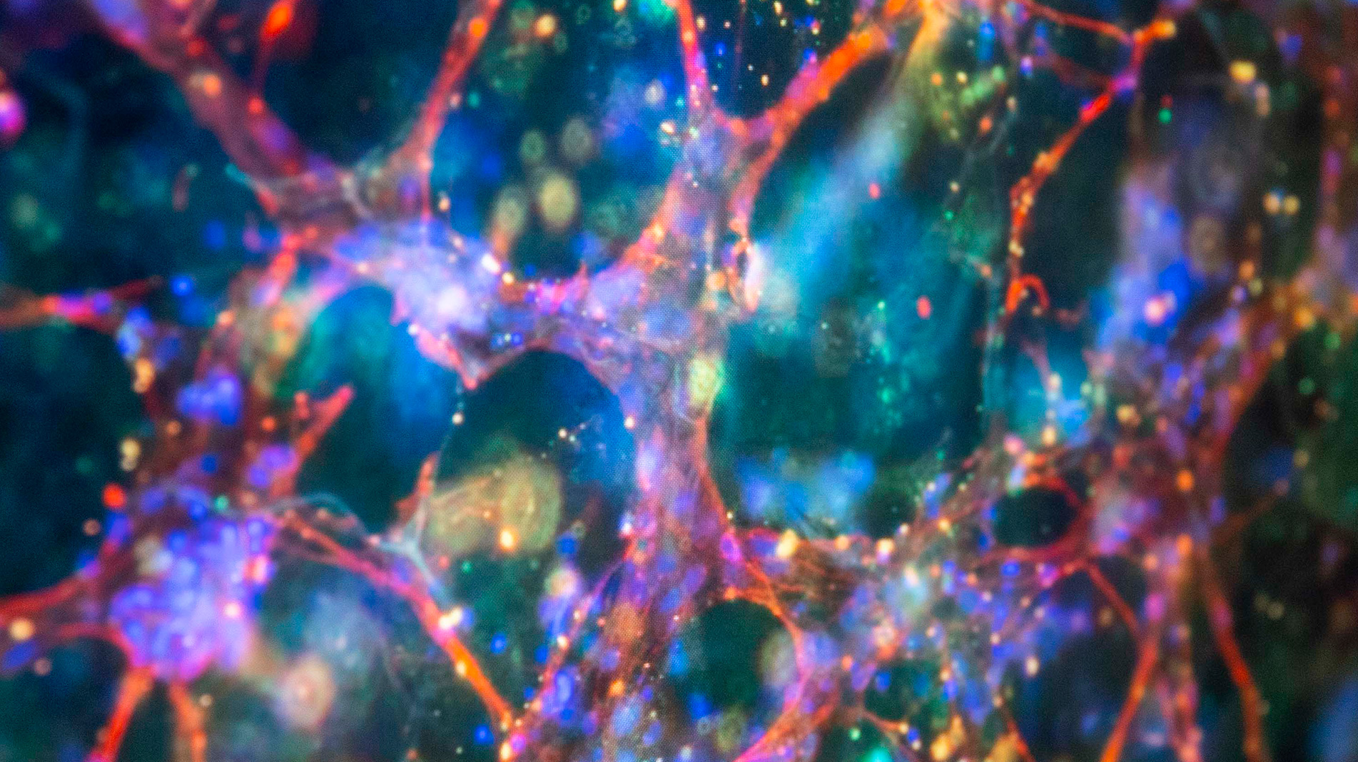 Immunostained neuron stem cells