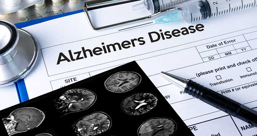 a medical form titled Alzheimer's Disease on a clipboard next to a brain x-ray, medication, and syringes